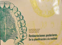 RESTAURACIONES POSTERIORES